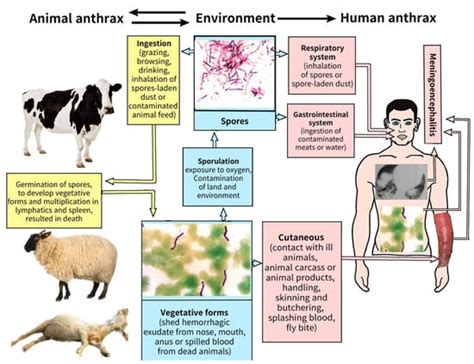 Diagnostics | Free Full-Text | Human Anthrax: Update of the Diagnosis and Treatment