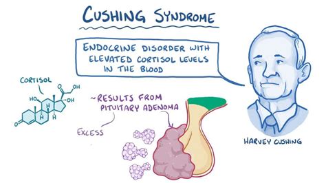 Cushing's Syndrome Pathophysiology