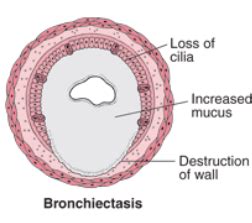 Bronchitis in Dogs Symptoms and Treatment (Updated March 2020)