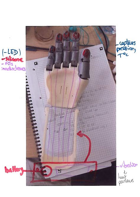 Economic Prosthetic Hand | Hackaday.io