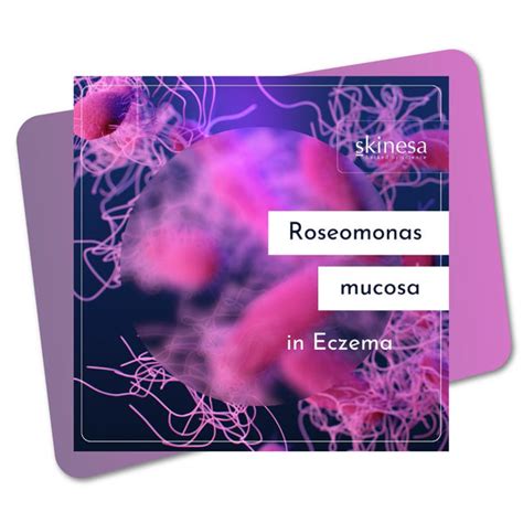 Roseomonas mucosa in Eczema - Skinesa