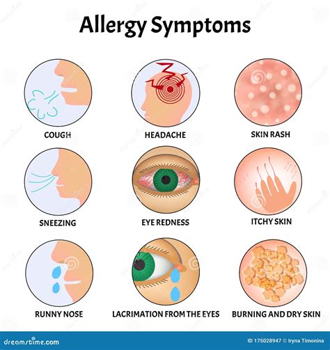 Symptoms of Allergies Skin Rash, Allergic Skin Itching, Tearing from ...