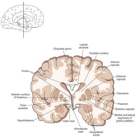 Cross section of the brain depicting the position occupied by the anterior thalamic nucleus in ...