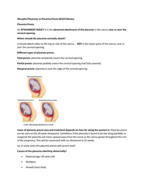 Abruptio Placentae vs Placenta Previa Nclex Review - Abruptio Placentae vs Placenta Previa NCLEX ...