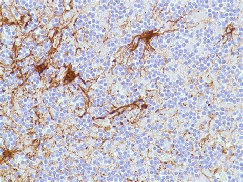 Brain Injury IHC Marker Antibody Duo (GFAP, MMP9) (ARG30292) - arigo Biolaboratories