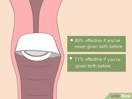 How to Use a Cervical Cap - wikiHow