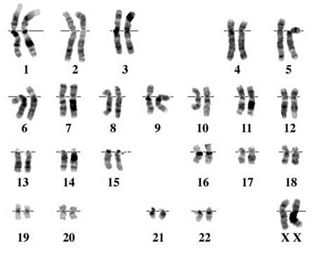 【euploidy】什么意思_英语euploidy的翻译_音标_读音_用法_例句_在线翻译_有道词典