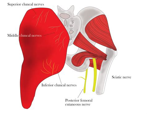 Does Cluneal Nerve Entrapment Really Cause Back Pain? - Massage ...