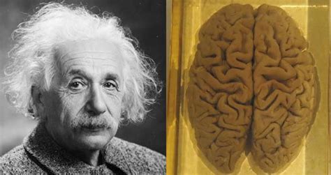 How Did Albert Einstein Die? Inside His Tragic Final Days