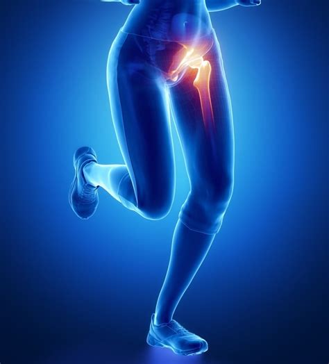 Hip Arthroscopy Surgery - Hip Specialist | Baton Rouge, LA