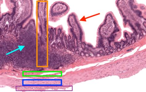 Ileum Histology Flashcards | Quizlet