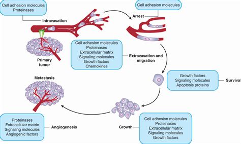 Tumor Progression and Metastasis | Oncohema Key