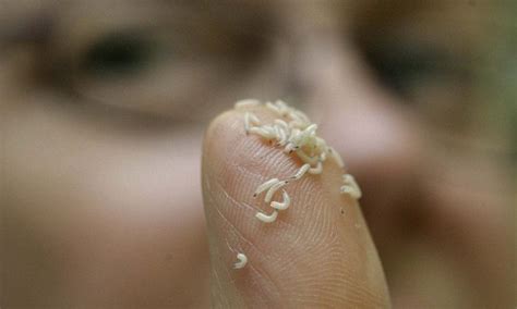 MAGGOTS set to make a comeback in medicine | Daily Mail Online