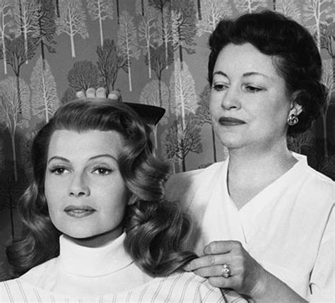 Rita Hayworth Hairline Before After