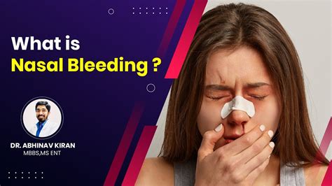 Nasal Bleeding Treatment | Dr. Abhinav Kiran | Vivekananda Hospital - YouTube