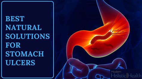 Best Natural Solutions for Stomach Ulcers | Modern Holistic Health