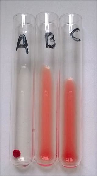 Tube Agglutination Test