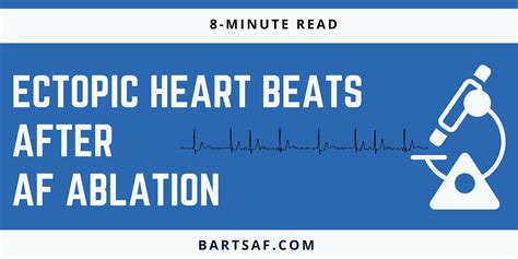 Extra heart beats after ablation