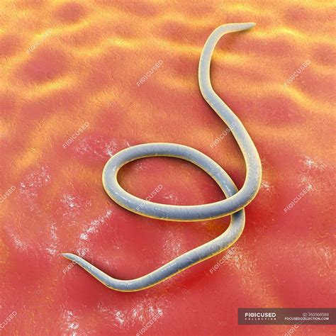 Parasitic nematode worm — many, parasite - Stock Photo | #160568588