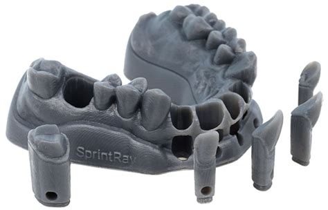 Dental 3D printing is now big business - Market Business News