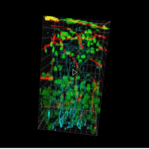 Quantitative Stimulated Raman Scattering Microscopy: From Molecules to Animals | Webinars ...