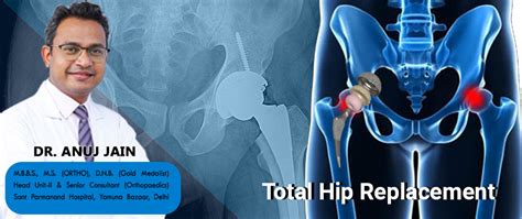 Best Hip Replacement Surgeon in Noida Delhi NCR - Dr. Anuj Jain