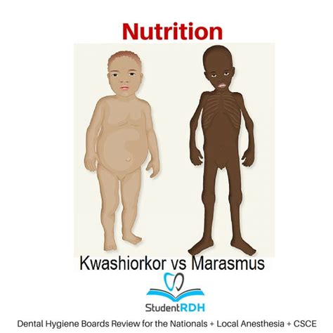 protein deficiency symptoms - DrBeckmann