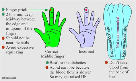 Blood Sample: – Part 3 – Types of Blood Samples, Criteria for rejection of the blood sample ...