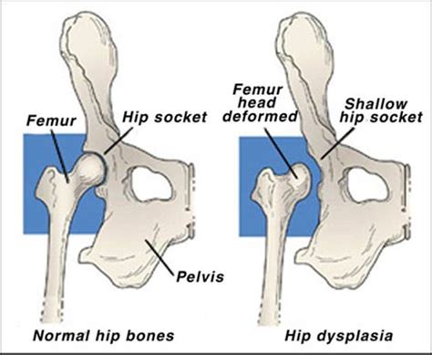 Are Dogs Prone To Hip Dysplasia