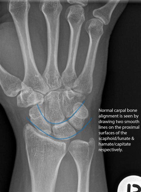 Not Your Typical Wrist Pain — EM Curious