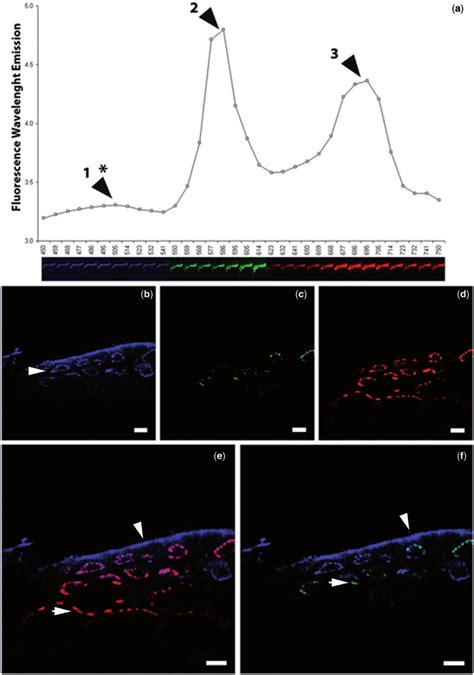 LSCM multispectral fluorescence analysis of L. translucida cortical and... | Download Scientific ...