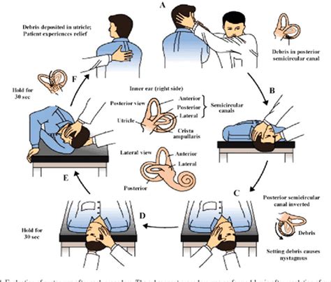 Figure 1 from Advances in the diagnosis and treatment of benign ...