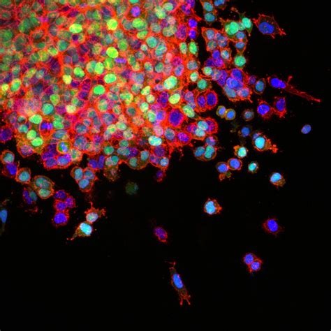 Fostering New Advances in Lung Cancer Research - American Association for Cancer Research (AACR)