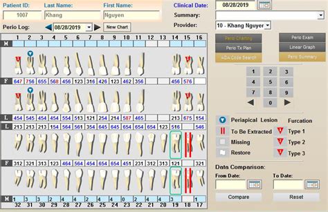 PERIODONTAL CHARTING – Eprosystem