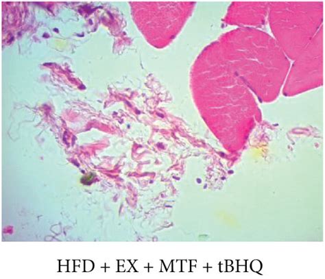 Gastrocnemii’s epimysium histology of HFD-treated groups.... | Download Scientific Diagram