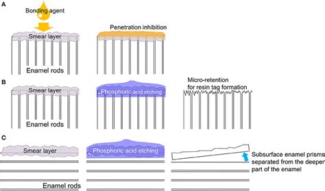 Frontiers | Update on Enamel Bonding Strategies