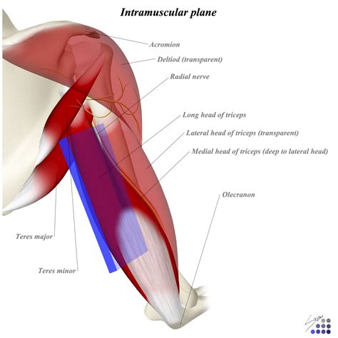 Humerus Posterior Approach - Anatomy - Medbullets Step 2/3