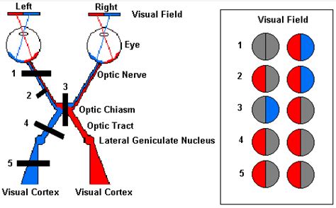 Neuroscience For Kids - Visual Pathway