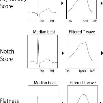 Calculation of T-wave morphology parameters. | Download Scientific Diagram