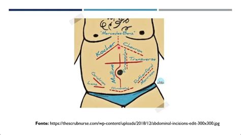 ANATOMIA DE INCISÕES CIRURGICAS ABDOMINAIS - YouTube