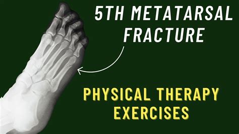 Metatarsal