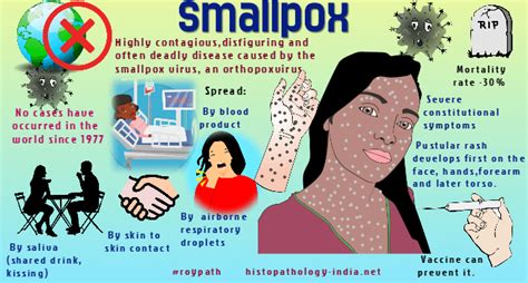 Pathology of Smallpox Virus Infection (Variola Virus)- Dr Sampurna Roy MD