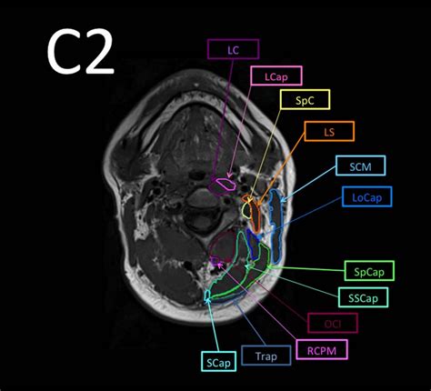 Cervical MRI Anatomy