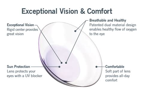 Duette Multifocal - SynergEyes