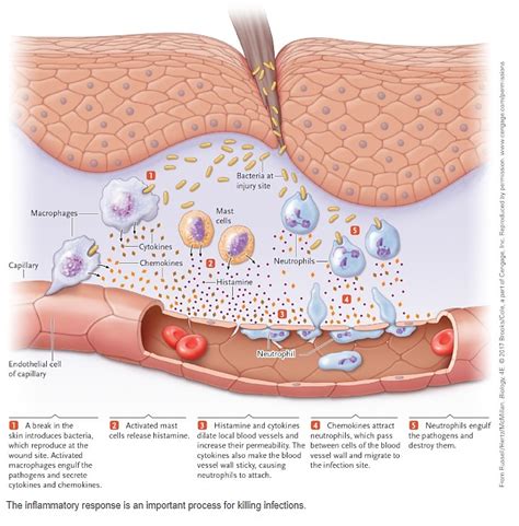 What is inflammation? - Dr Wendi's Health