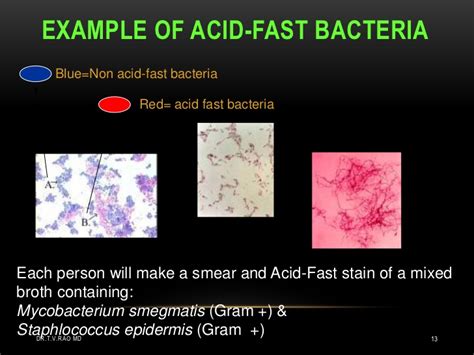 Acid fast bacteria (AFB)