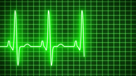 Animation of an Electrocardiography (ecg) Stock Footage Video (100% Royalty-free) 28831363 ...