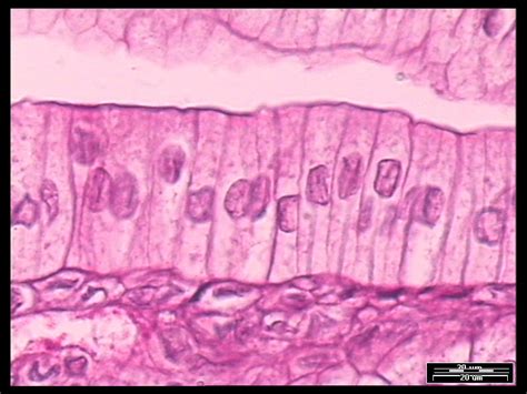 Kinds of Epithelial Tissues