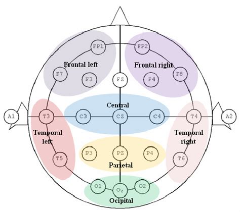 Basic Eeg Lead Placement Diagram