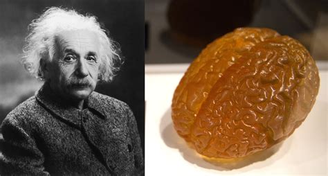 Where is Einstein's brain? | Live Science